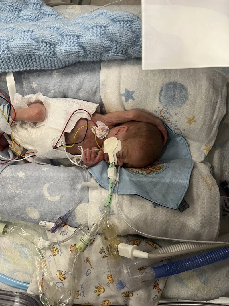 Other image for Little miracle Billy home at last